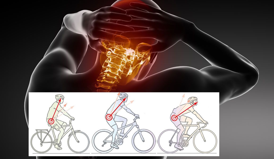 Dói-te o pescoço quando andas de bicicleta?
