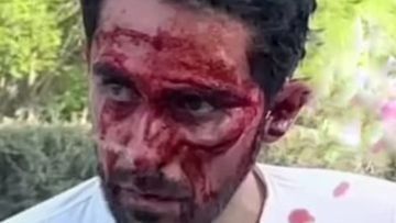 Alberto Contador sofreu violenta queda num passeio de cicloturismo na China