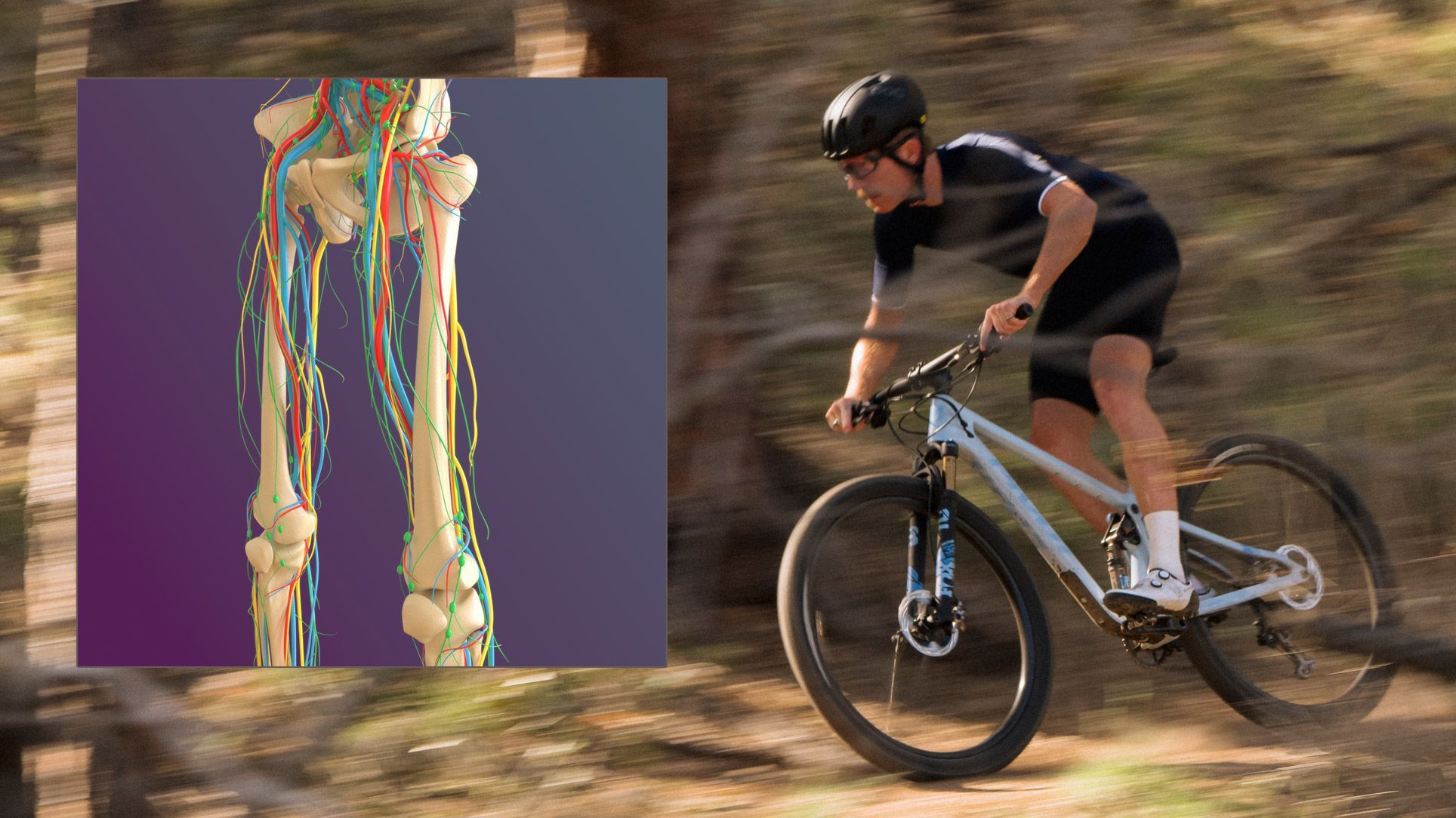 Endofibrose, uma lesão muito comum nos ciclistas